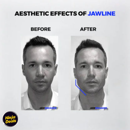 Jawline Exerciser Tool Men & Women - Helps to Reduce Stress and Cravings, Slim and Tone Your Face